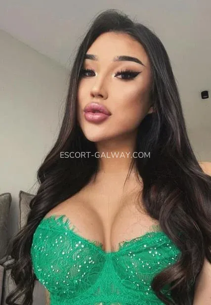 Escort Galway Ruby — 4