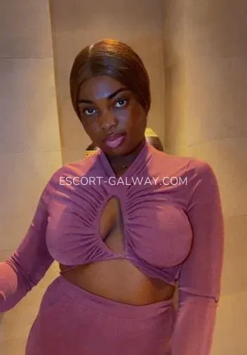 Escort Galway Rebecca — 3