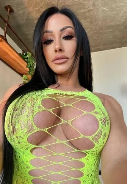 Escort Galway Alexandra — 3