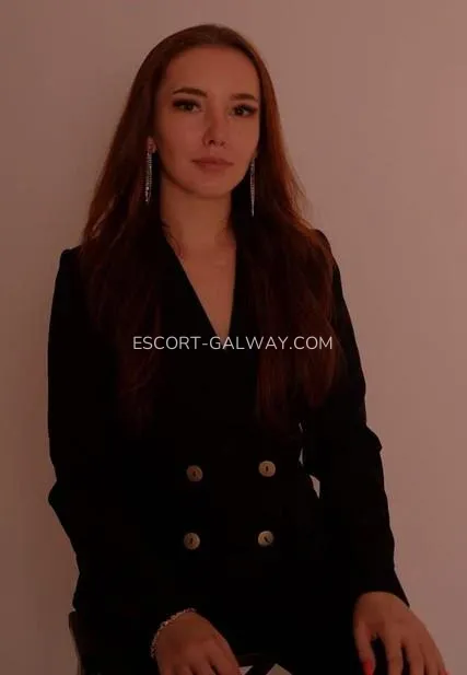 Escort Galway Alexandra — 5