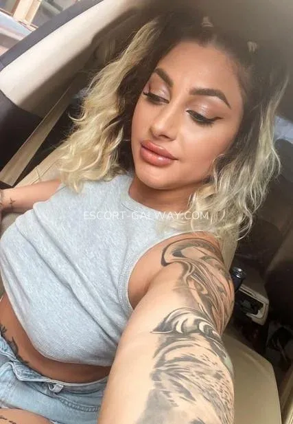 Escort Galway Mckenzie — 1