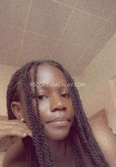 Escort Galway Melissa — 6