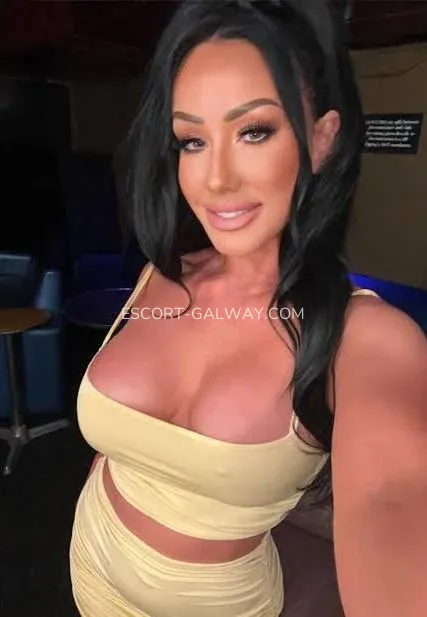 Escort Galway Alexandra — 4